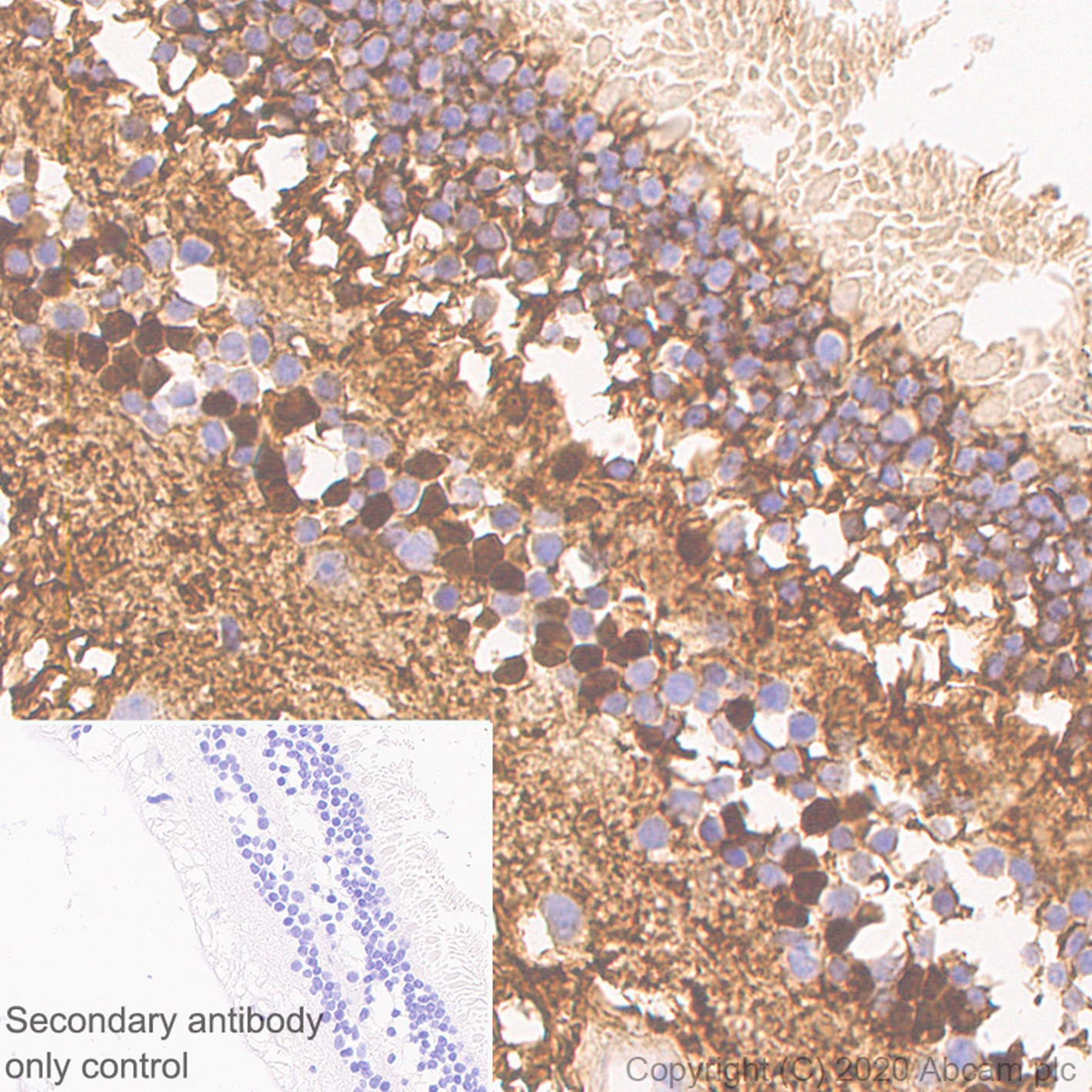 Immunohistochemistry (Formalin/PFA-fixed paraffin-embedded sections) - Rabbit monoclonal [M1gG51-4] Anti-Mouse IgG1 H&L (ab125913), expandable thumbnail