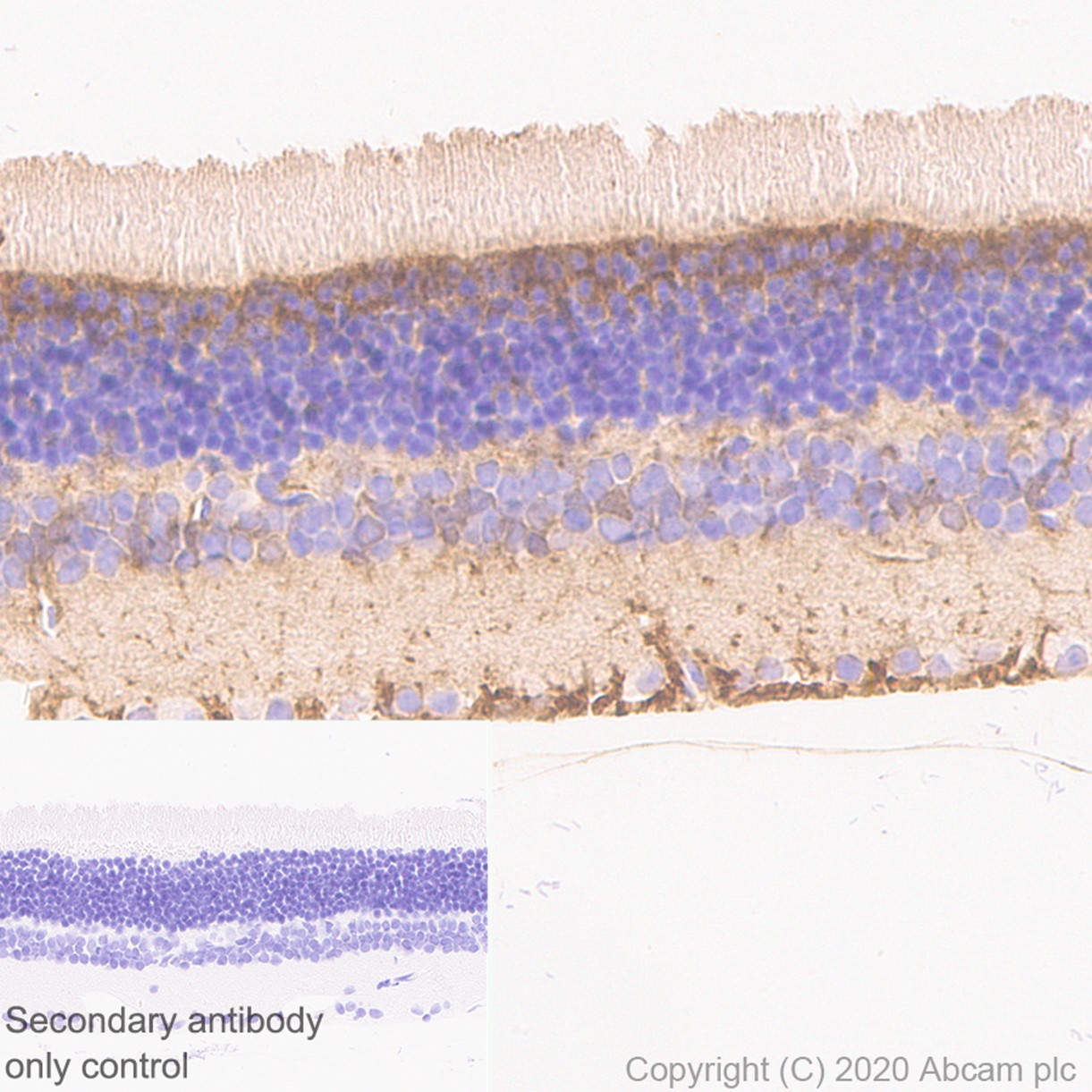 Immunohistochemistry (Formalin/PFA-fixed paraffin-embedded sections) - Rabbit monoclonal [M1gG51-4] Anti-Mouse IgG1 H&L (ab125913), expandable thumbnail