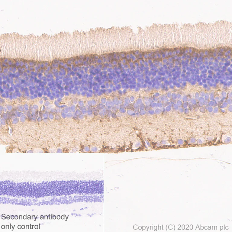 Immunohistochemistry (Formalin/PFA-fixed paraffin-embedded sections) - Rabbit monoclonal [M1gG51-4] Anti-Mouse IgG1 H&L (AB125913)