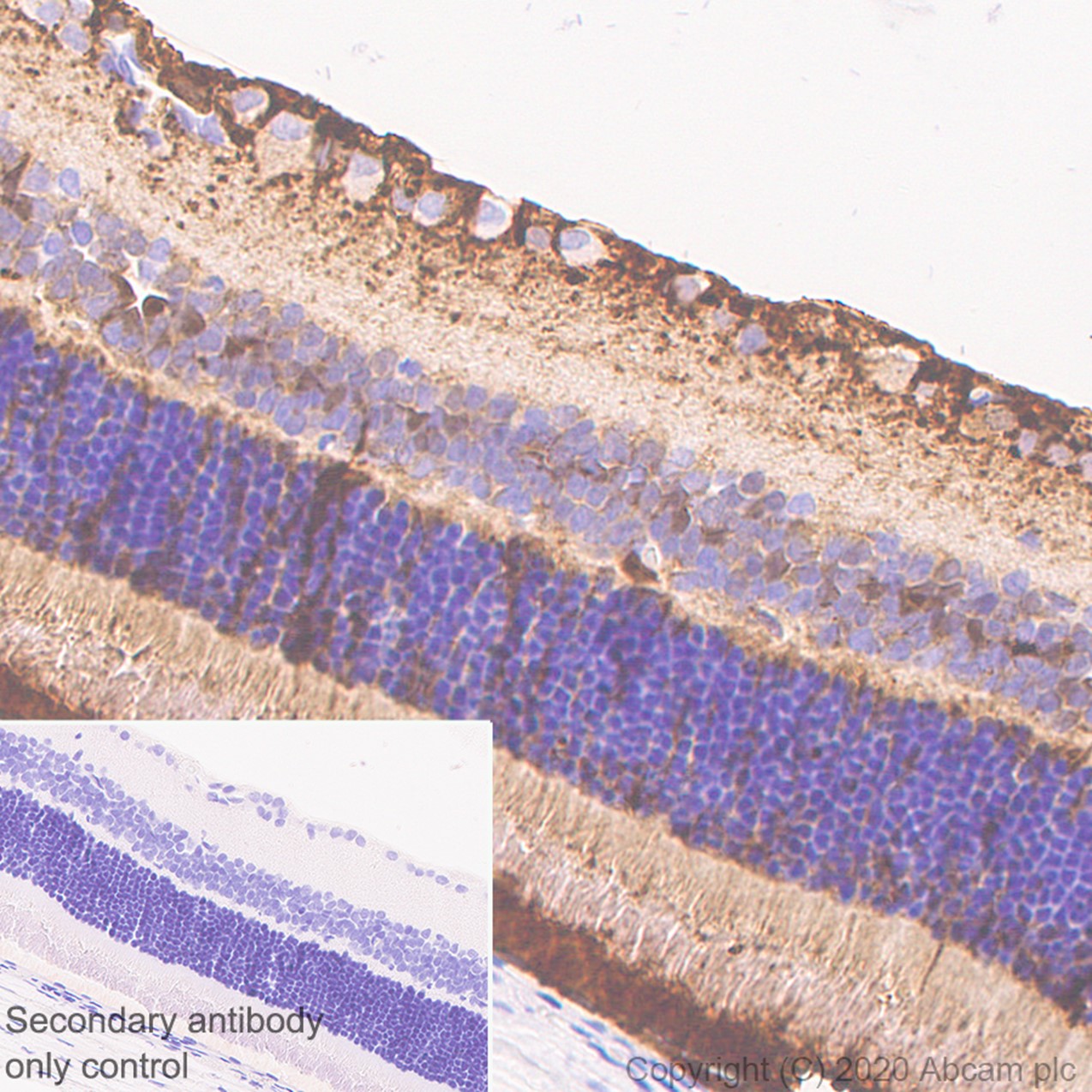 Immunohistochemistry (Formalin/PFA-fixed paraffin-embedded sections) - Rabbit monoclonal [M1gG51-4] Anti-Mouse IgG1 H&L (ab125913), expandable thumbnail