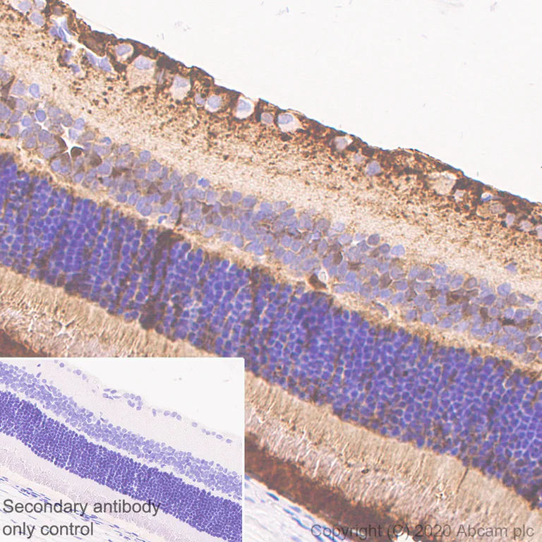 Immunohistochemistry (Formalin/PFA-fixed paraffin-embedded sections) - Rabbit monoclonal [M1gG51-4] Anti-Mouse IgG1 H&L (AB125913)