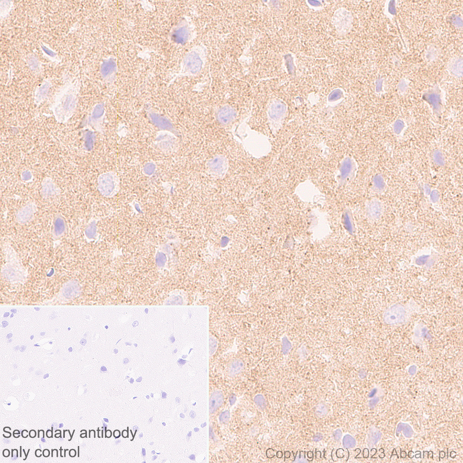 Immunohistochemistry (Formalin/PFA-fixed paraffin-embedded sections) - Rabbit monoclonal [M1gG51-4] Anti-Mouse IgG1 H&L (ab125913), expandable thumbnail