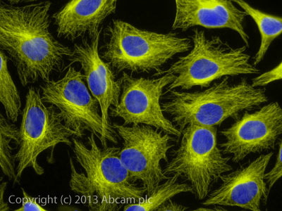 Immunocytochemistry/ Immunofluorescence - Rabbit Anti-Mouse IgG H&L (Alexa Fluor® 555) preadsorbed (AB150126), expandable thumbnail