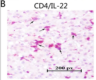 Immunohistochemistry (Formalin/PFA-fixed paraffin-embedded sections) - Rabbit Anti-Mouse IgG H&L (HRP) (AB6728)