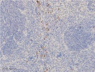 Immunohistochemistry (Formalin/PFA-fixed paraffin-embedded sections) - Rabbit Anti-Mouse IgG H&L (HRP) (AB6728)