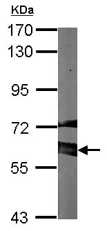 Western blot - Rabbit polyclonal to GAD67/GAD1 (AB97739), expandable thumbnail