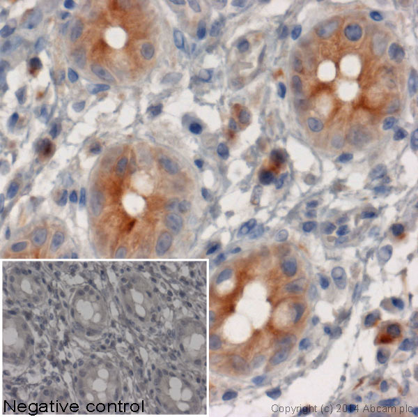 Immunohistochemistry (Formalin/PFA-fixed paraffin-embedded sections) - Rabbit Anti-Rat IgG H&L (HRP) (AB6734), expandable thumbnail