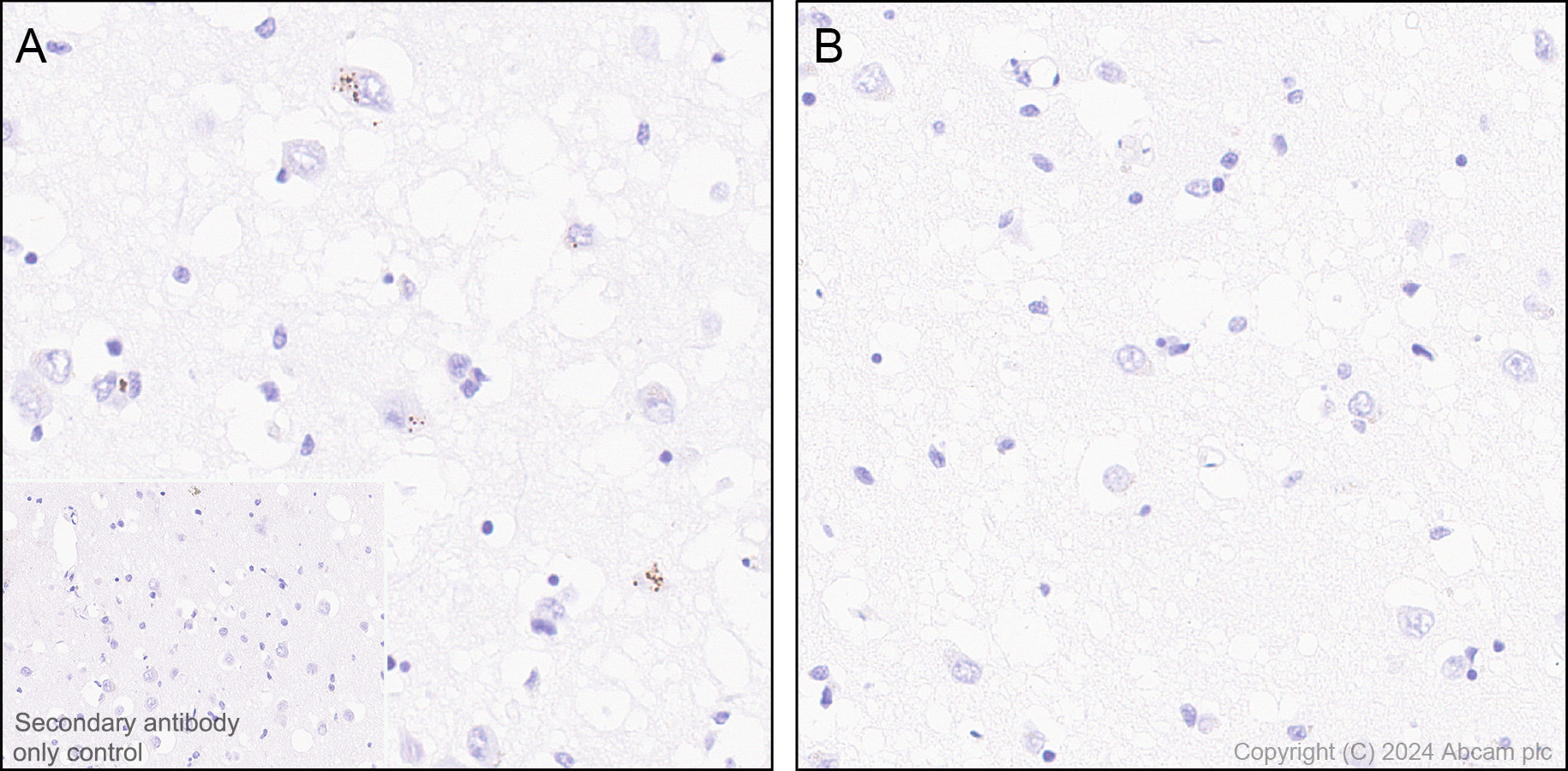 Immunohistochemistry (Formalin/PFA-fixed paraffin-embedded sections) - Rabbit Anti-Rat IgG H&L preadsorbed (AB102248), expandable thumbnail