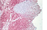 Immunohistochemistry (Formalin/PFA-fixed paraffin-embedded sections) - Rabbit specific HRP/AEC Detection IHC Kit (AB64260)