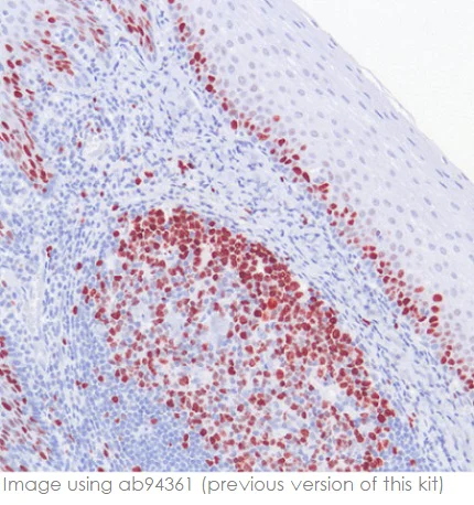 Immunohistochemistry (Formalin/PFA-fixed paraffin-embedded sections) - Rabbit specific HRP/AEC IHC Detection Kit - Micro-polymer (AB236468)