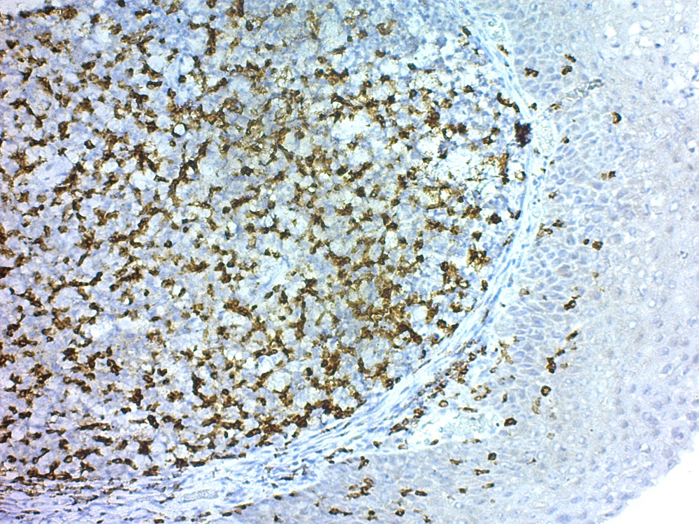 Immunohistochemistry (Formalin/PFA-fixed paraffin-embedded sections) - Rabbit specific HRP/DAB Detection IHC Detection Kit - Micro-polymer (AB236469), expandable thumbnail