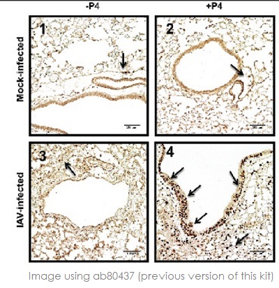 Immunohistochemistry (Formalin/PFA-fixed paraffin-embedded sections) - Rabbit specific HRP/DAB Detection IHC Detection Kit - Micro-polymer (AB236469), expandable thumbnail