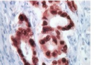 Immunohistochemistry (Formalin/PFA-fixed paraffin-embedded sections) - Rabbit specific HRP/DAB Detection IHC Kit (AB64261), expandable thumbnail
