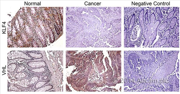 Immunohistochemistry (Formalin/PFA-fixed paraffin-embedded sections) - Rabbit specific HRP/DAB Detection IHC Kit (AB64261), expandable thumbnail
