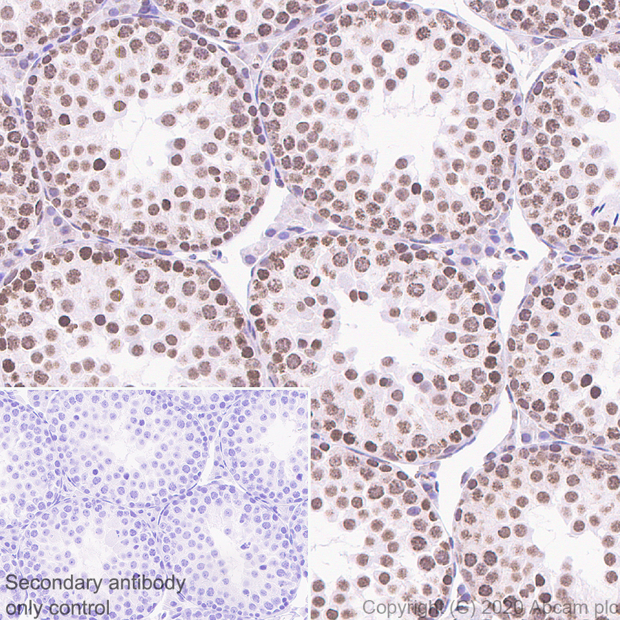 Immunohistochemistry (Formalin/PFA-fixed paraffin-embedded sections) - Rabbit specific IHC polymer detection kit HRP/DAB (ab209101), expandable thumbnail