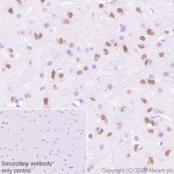 Immunohistochemistry (Formalin/PFA-fixed paraffin-embedded sections) - Rabbit specific IHC polymer detection kit HRP/DAB (AB209101), expandable thumbnail