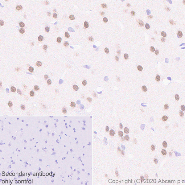 Immunohistochemistry (Formalin/PFA-fixed paraffin-embedded sections) - Rabbit specific IHC polymer detection kit HRP/DAB (AB209101), expandable thumbnail