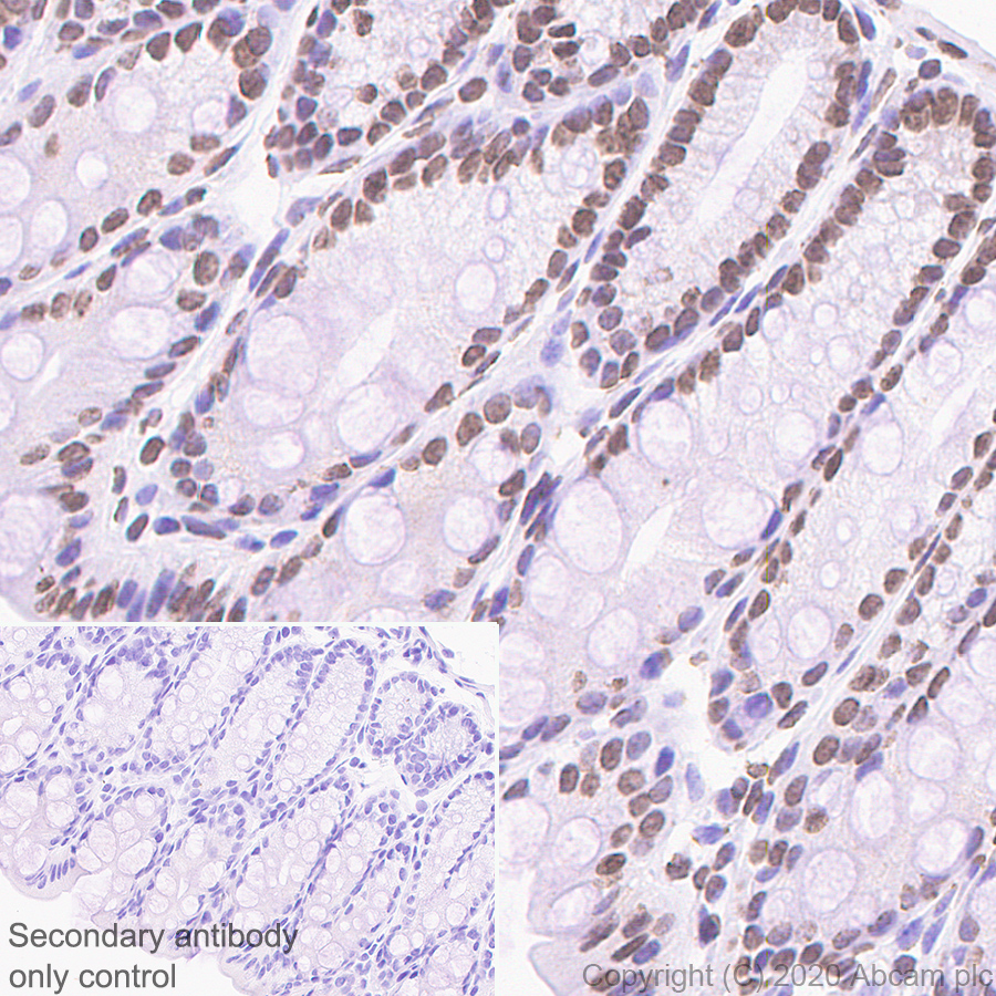 Immunohistochemistry (Formalin/PFA-fixed paraffin-embedded sections) - Rabbit specific IHC polymer detection kit HRP/DAB (AB209101), expandable thumbnail