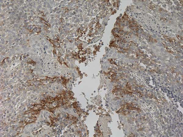 Immunohistochemistry (Formalin/PFA-fixed paraffin-embedded sections) - Rabbit specific IHC polymer detection kit HRP/DAB (ab209101), expandable thumbnail