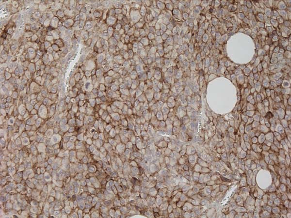 Immunohistochemistry (Formalin/PFA-fixed paraffin-embedded sections) - Rabbit specific IHC polymer detection kit HRP/DAB (ab209101), expandable thumbnail