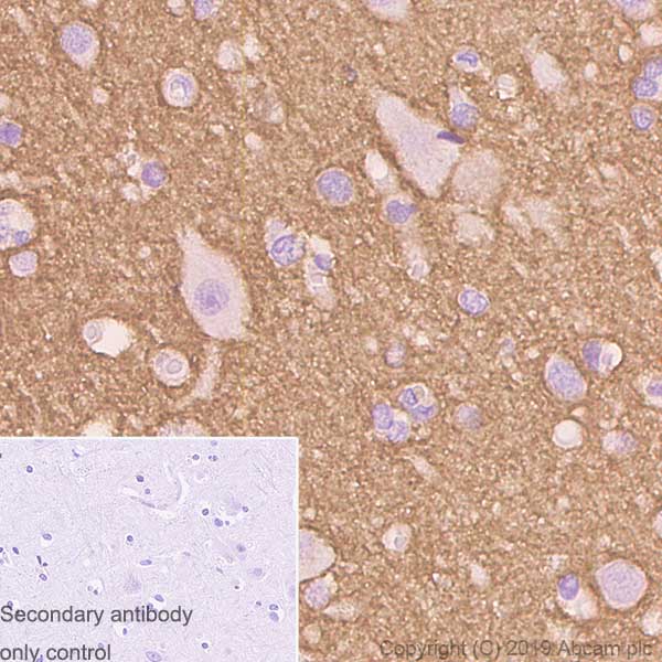 Immunohistochemistry (Formalin/PFA-fixed paraffin-embedded sections) - Rabbit specific IHC polymer detection kit HRP/DAB (ab209101), expandable thumbnail