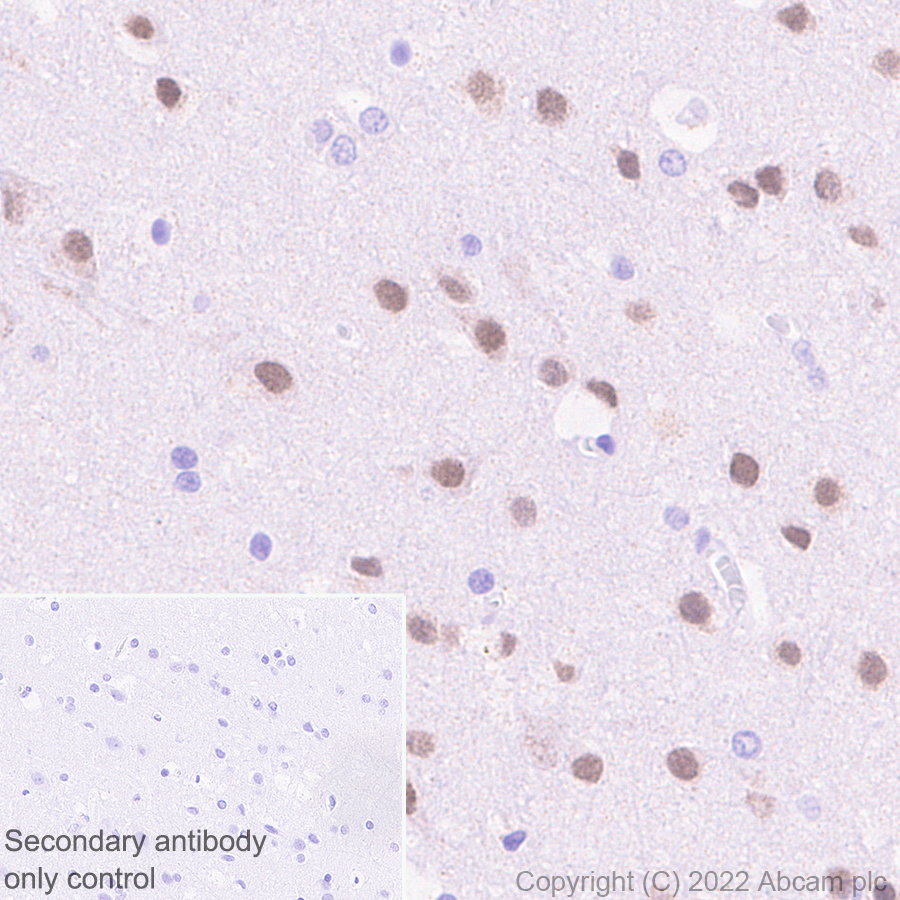 Immunohistochemistry (Formalin/PFA-fixed paraffin-embedded sections) - Rabbit specific IHC polymer detection kit HRP/DAB (ab209101), expandable thumbnail