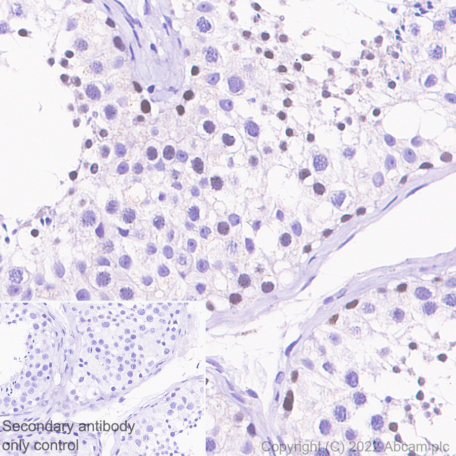 Immunohistochemistry (Formalin/PFA-fixed paraffin-embedded sections) - Rabbit specific IHC polymer detection kit HRP/DAB (ab209101), expandable thumbnail