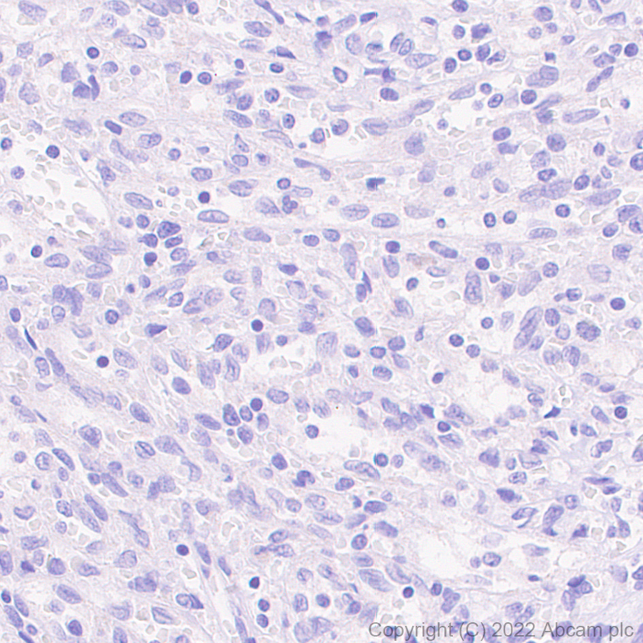 Immunohistochemistry (Formalin/PFA-fixed paraffin-embedded sections) - Rabbit specific IHC polymer detection kit HRP/DAB (ab209101), expandable thumbnail