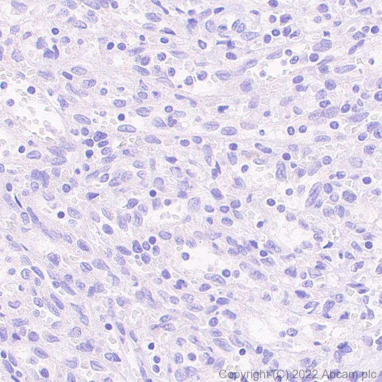 Immunohistochemistry (Formalin/PFA-fixed paraffin-embedded sections) - Rabbit specific IHC polymer detection kit HRP/DAB (AB209101)
