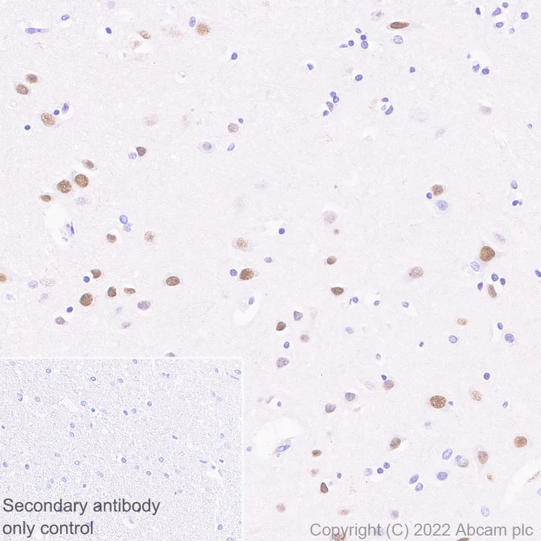 Immunohistochemistry (Formalin/PFA-fixed paraffin-embedded sections) - Rabbit specific IHC polymer detection kit HRP/DAB (AB209101)