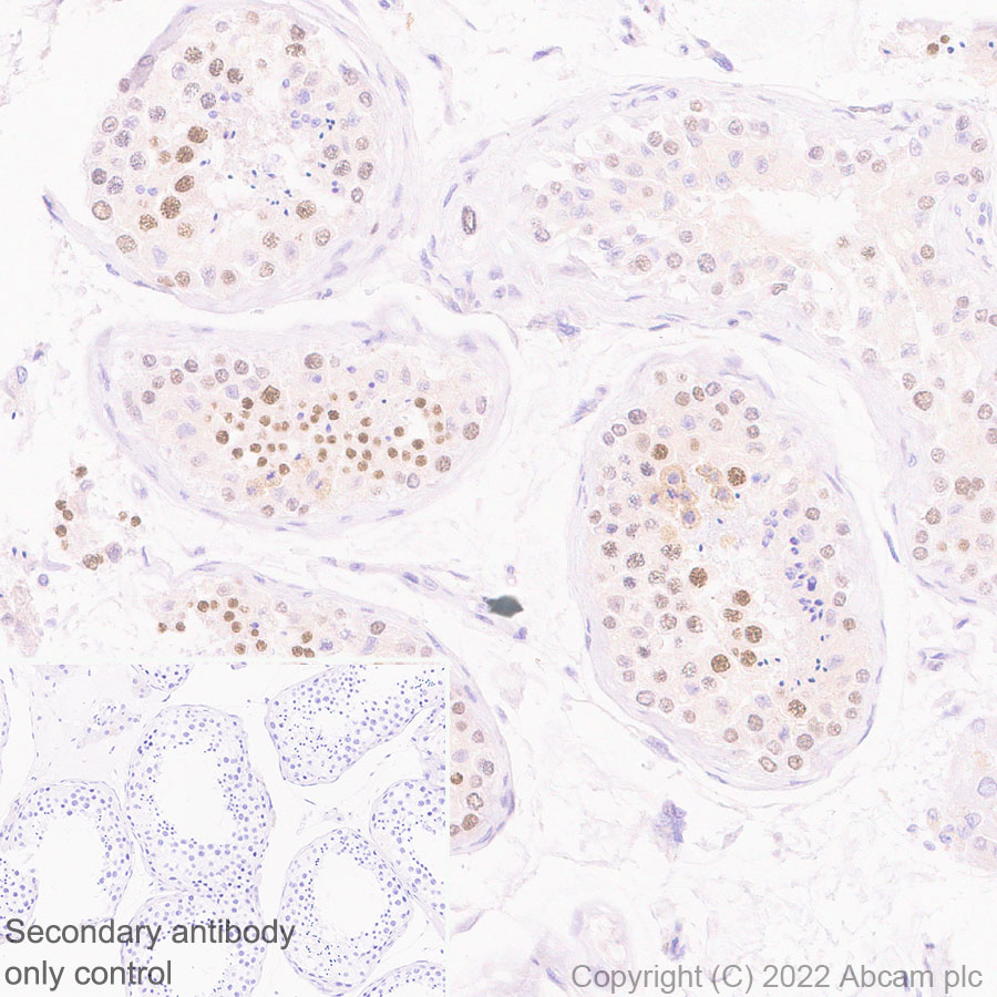 Immunohistochemistry (Formalin/PFA-fixed paraffin-embedded sections) - Rabbit specific IHC polymer detection kit HRP/DAB (ab209101), expandable thumbnail