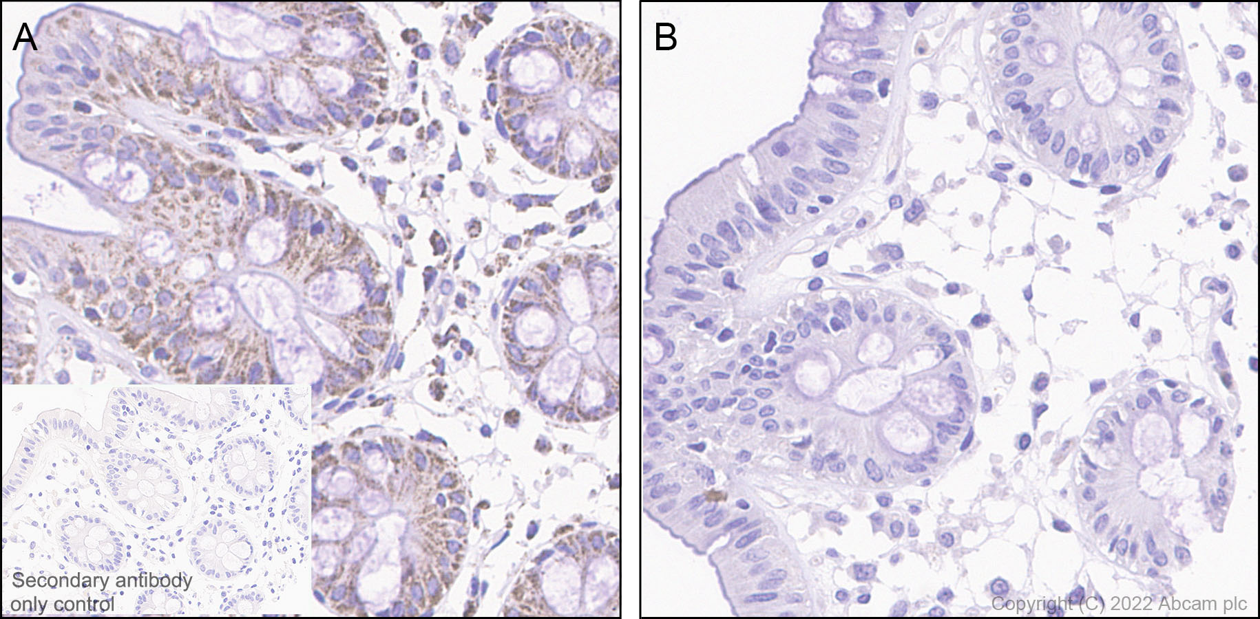 Immunohistochemistry (Formalin/PFA-fixed paraffin-embedded sections) - Rabbit specific IHC polymer detection kit HRP/DAB (ab209101), expandable thumbnail