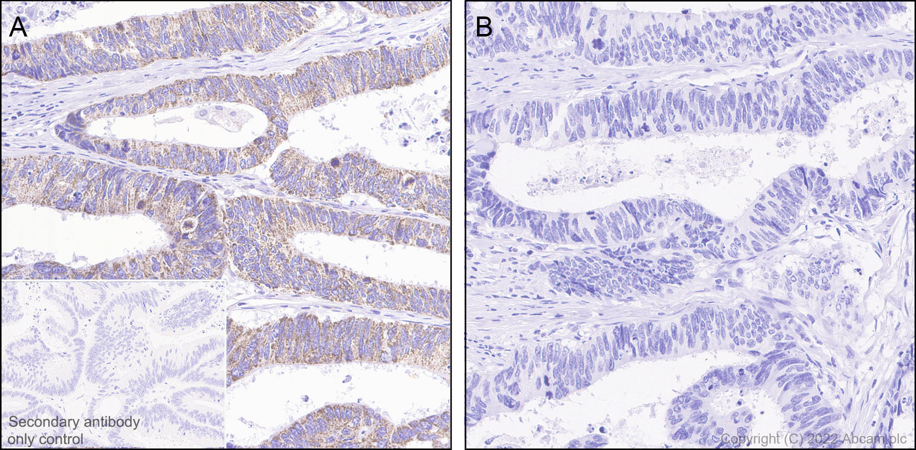 Immunohistochemistry (Formalin/PFA-fixed paraffin-embedded sections) - Rabbit specific IHC polymer detection kit HRP/DAB (ab209101), expandable thumbnail
