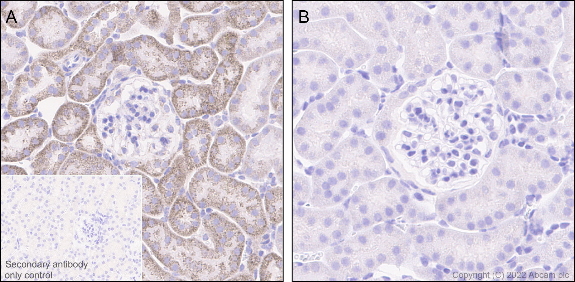 Immunohistochemistry (Formalin/PFA-fixed paraffin-embedded sections) - Rabbit specific IHC polymer detection kit HRP/DAB (ab209101), expandable thumbnail