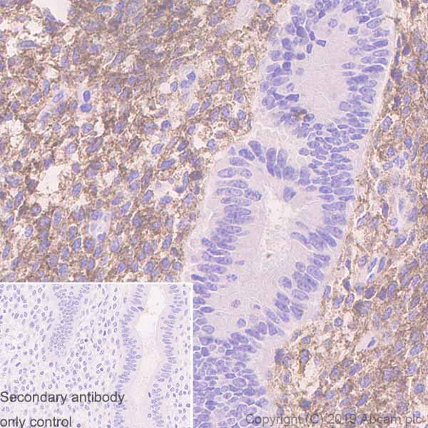 Immunohistochemistry (Formalin/PFA-fixed paraffin-embedded sections) - Rabbit specific IHC polymer detection kit HRP/DAB (ab209101), expandable thumbnail