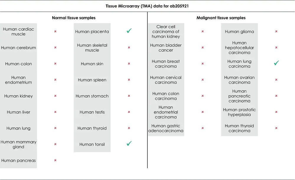 Immunohistochemistry (Formalin/PFA-fixed paraffin-embedded sections) - Rabbit specific IHC polymer detection kit HRP/DAB (ab209101), expandable thumbnail