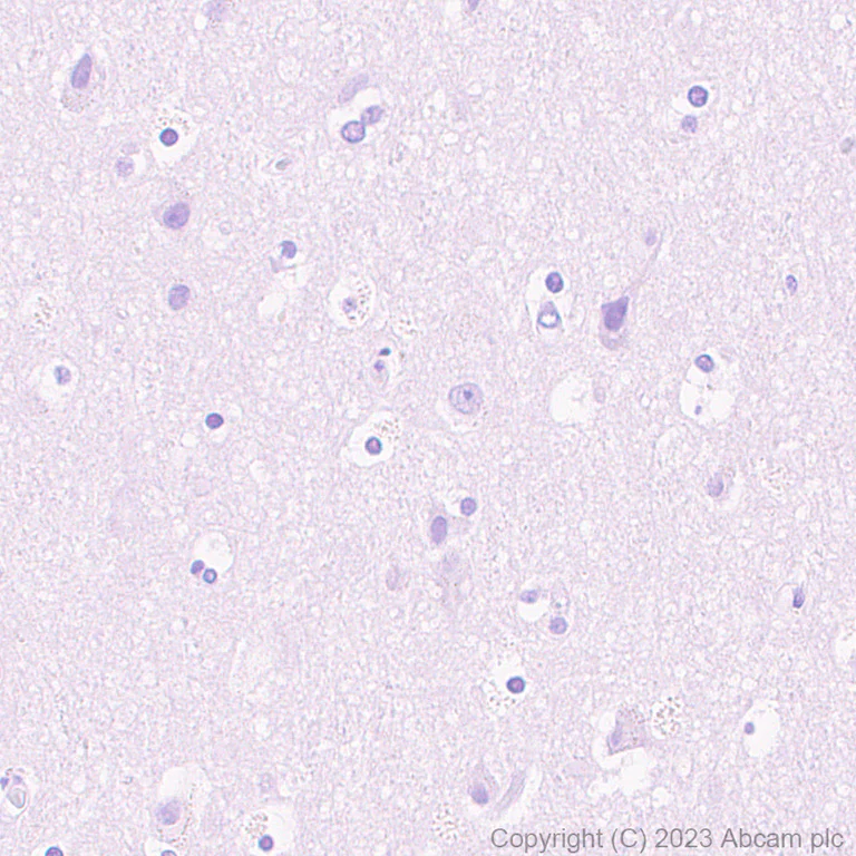 Immunohistochemistry (Formalin/PFA-fixed paraffin-embedded sections) - Rabbit specific IHC polymer detection kit HRP/DAB (AB209101)
