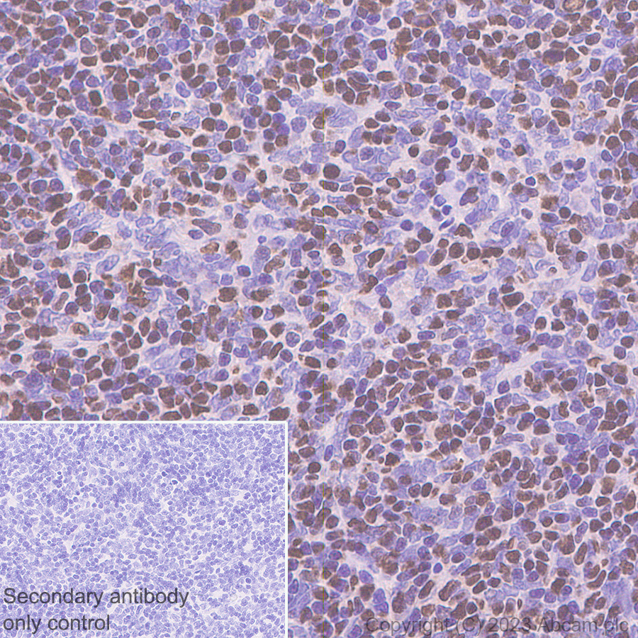 Immunohistochemistry (Formalin/PFA-fixed paraffin-embedded sections) - Rabbit specific IHC polymer detection kit HRP/DAB (ab209101), expandable thumbnail