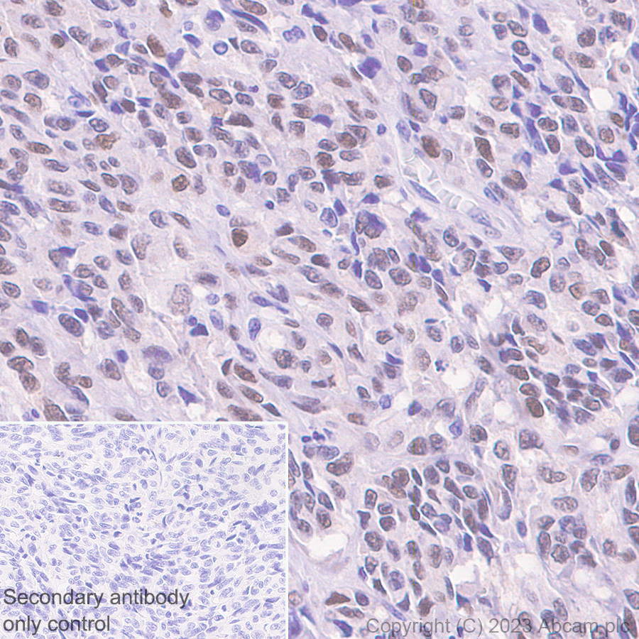 Immunohistochemistry (Formalin/PFA-fixed paraffin-embedded sections) - Rabbit specific IHC polymer detection kit HRP/DAB (ab209101), expandable thumbnail