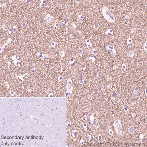 Immunohistochemistry (Formalin/PFA-fixed paraffin-embedded sections) - Rabbit specific IHC polymer detection kit HRP/DAB (AB209101)