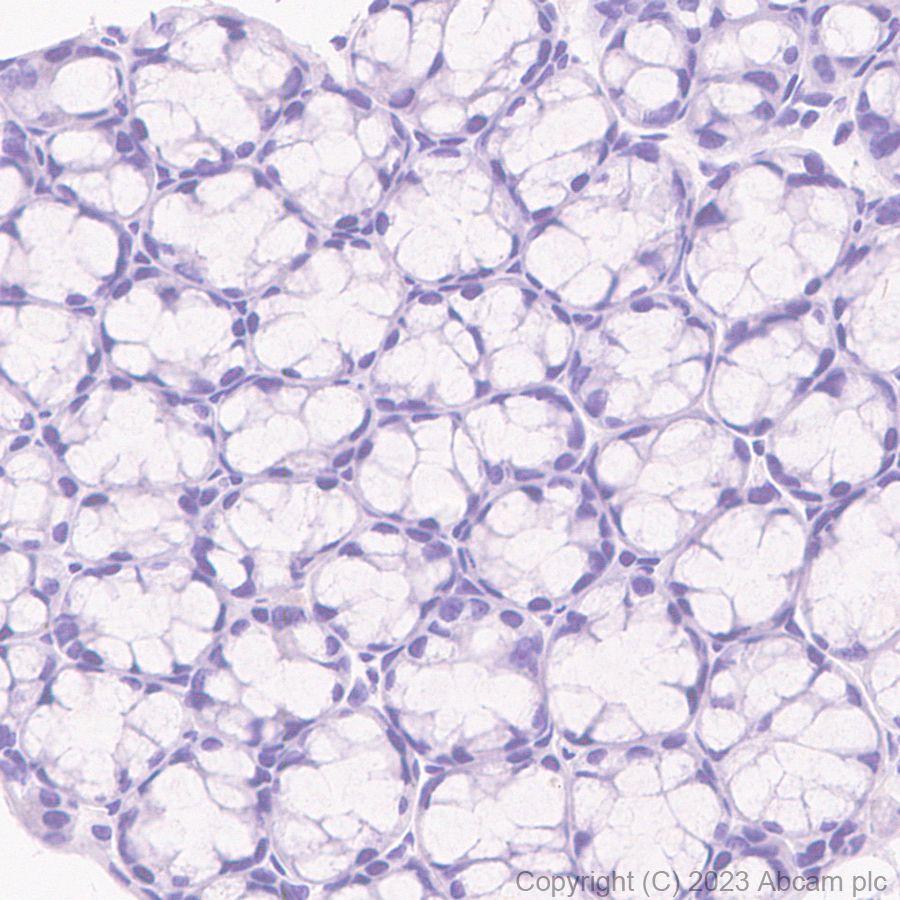 Immunohistochemistry (Formalin/PFA-fixed paraffin-embedded sections) - Rabbit specific IHC polymer detection kit HRP/DAB (ab209101), expandable thumbnail