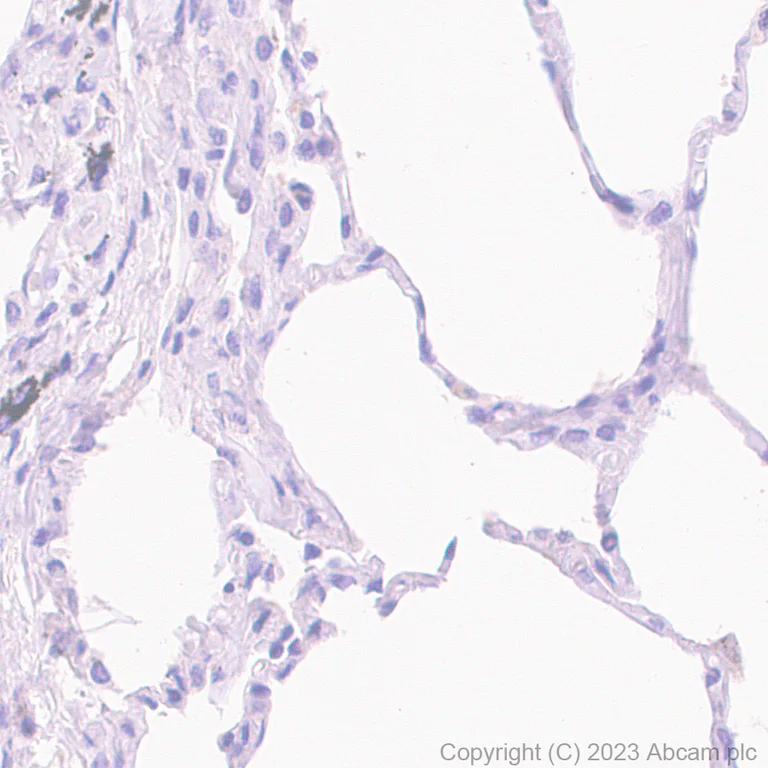 Immunohistochemistry (Formalin/PFA-fixed paraffin-embedded sections) - Rabbit specific IHC polymer detection kit HRP/DAB (AB209101)
