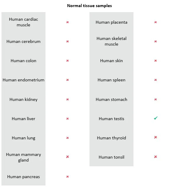 Immunohistochemistry (Formalin/PFA-fixed paraffin-embedded sections) - Rabbit specific IHC polymer detection kit HRP/DAB (AB209101)