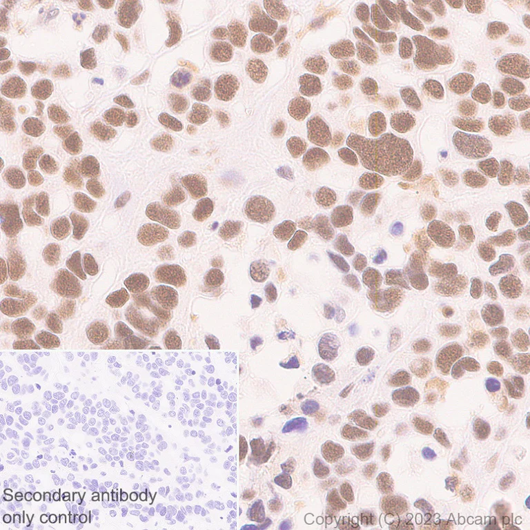 Immunohistochemistry (Formalin/PFA-fixed paraffin-embedded sections) - Rabbit specific IHC polymer detection kit HRP/DAB (AB209101)