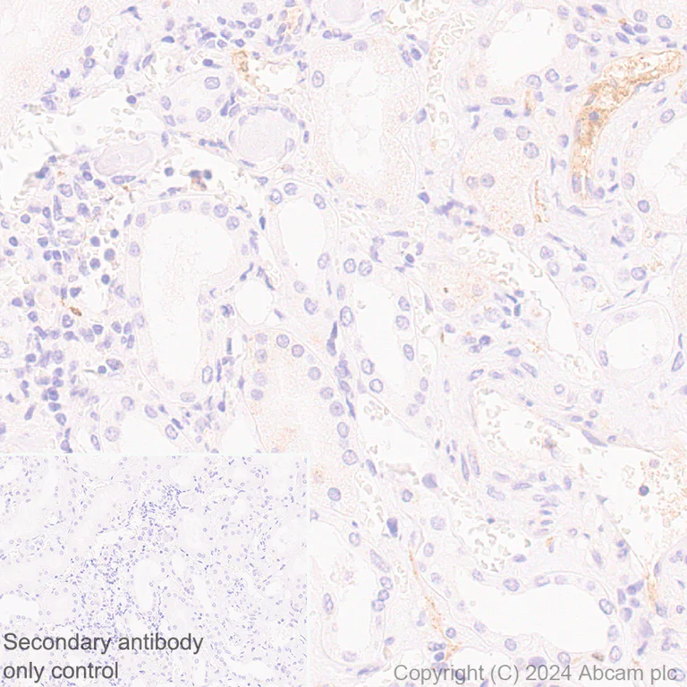 Immunohistochemistry (Formalin/PFA-fixed paraffin-embedded sections) - Rabbit specific IHC polymer detection kit HRP/DAB (AB209101)