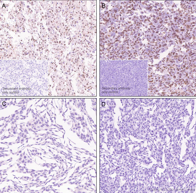 Immunohistochemistry (Formalin/PFA-fixed paraffin-embedded sections) - Rabbit specific IHC polymer detection kit HRP/DAB (AB209101)