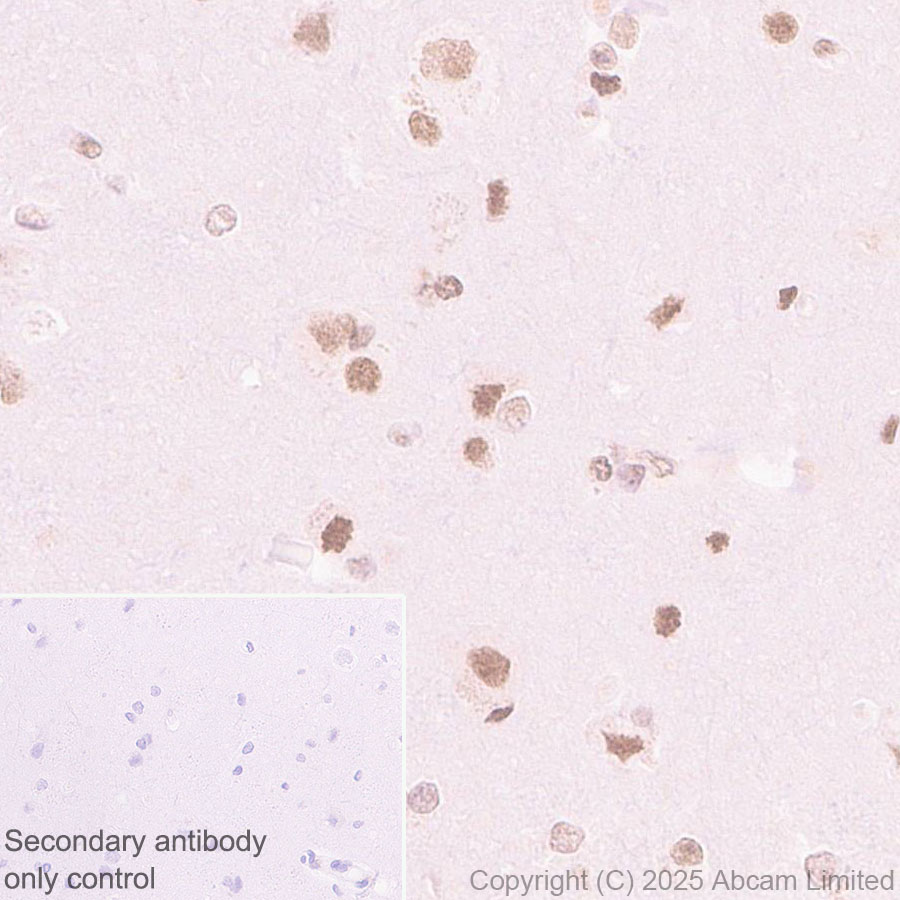 Immunohistochemistry (Formalin/PFA-fixed paraffin-embedded sections) - Rabbit specific IHC polymer detection kit HRP/DAB (ab209101), expandable thumbnail