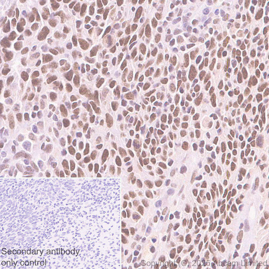 Immunohistochemistry (Formalin/PFA-fixed paraffin-embedded sections) - Rabbit specific IHC polymer detection kit HRP/DAB (ab209101), expandable thumbnail