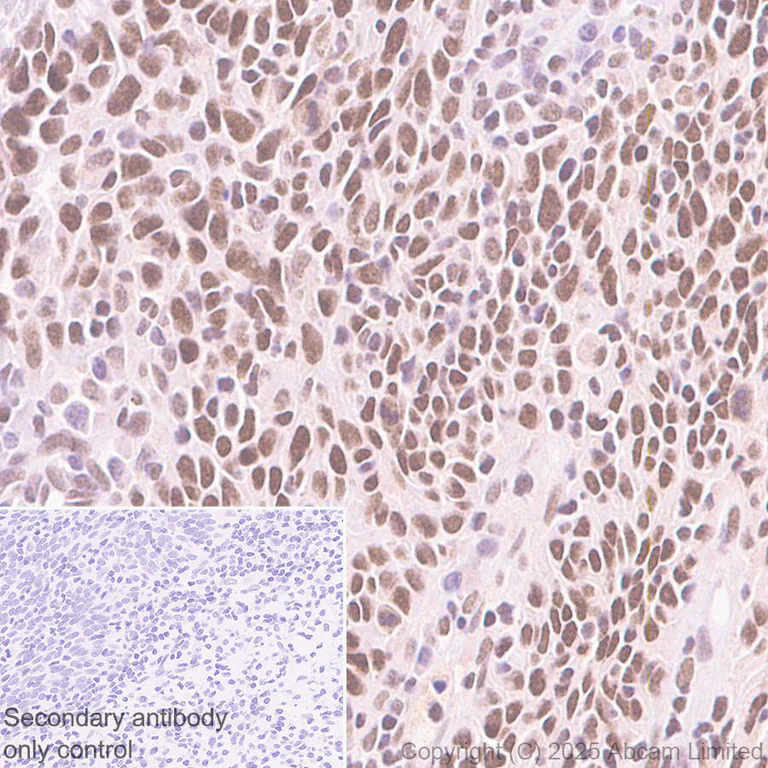 Immunohistochemistry (Formalin/PFA-fixed paraffin-embedded sections) - Rabbit specific IHC polymer detection kit HRP/DAB (AB209101)