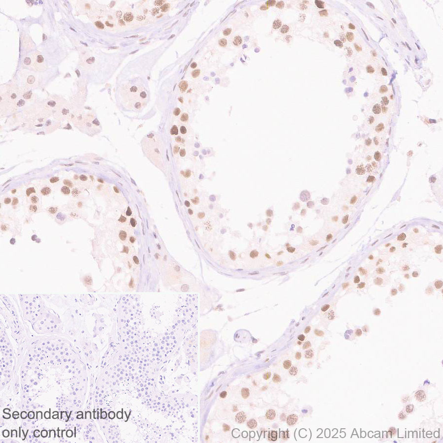 Immunohistochemistry (Formalin/PFA-fixed paraffin-embedded sections) - Rabbit specific IHC polymer detection kit HRP/DAB (ab209101), expandable thumbnail